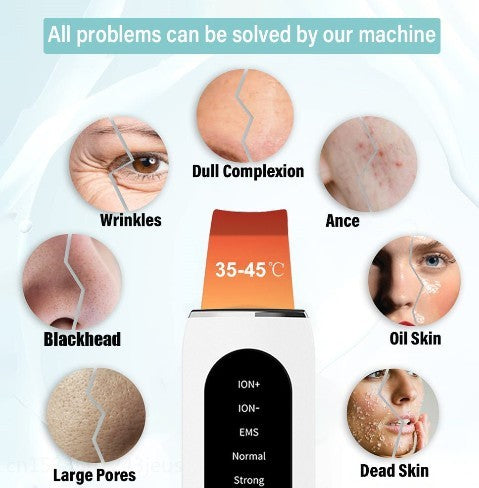 Shovel Skin Blackhead Ultrasonic Beauty Microcurrent Color Light